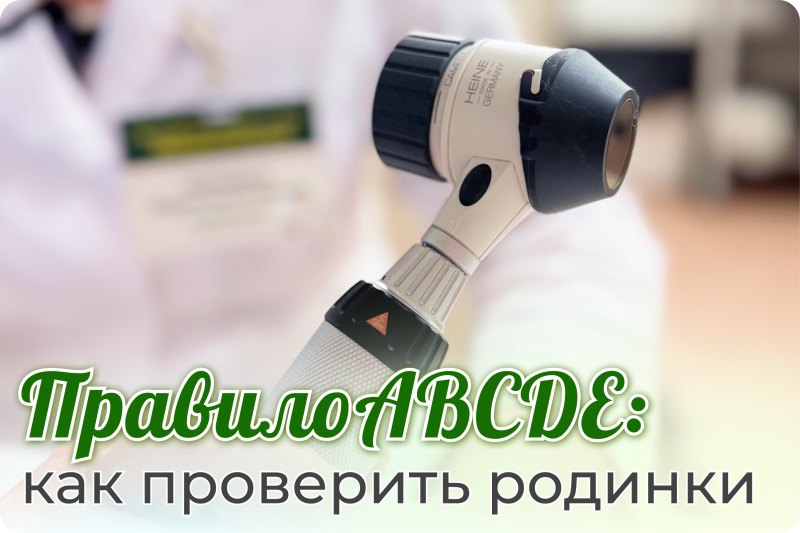 Правило ABCDE: как проверить родинки самостоятельно