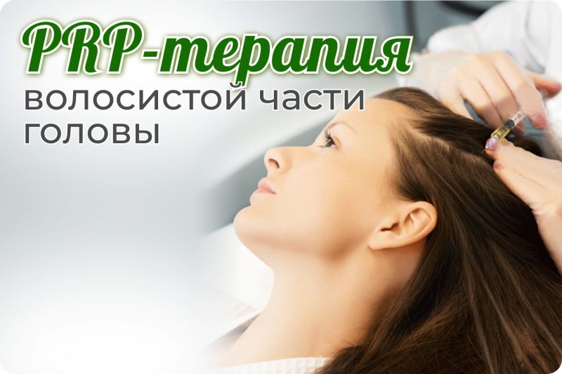 Лечение выпадения волос: как помогает PRP-терапия (плазмолифтинг)